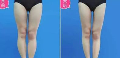 南方地區(qū)整形醫(yī)院評比：廣東區(qū)內(nèi)兩家醫(yī)療機構(gòu)獲得青睞