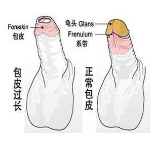 武漢哪家整形醫(yī)院的顴弓磨平手術(shù)更專業(yè)？2023年綜合實力排名揭曉！