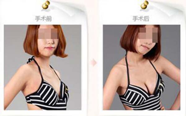 2023嘉興丨哪家整形醫(yī)院的肉毒素打法備受推崇？Top10排名等你來揭曉！