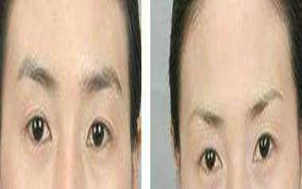 2023年推薦的隨州人工骨隆鼻醫(yī)療美容醫(yī)院，看看有哪些新面孔？