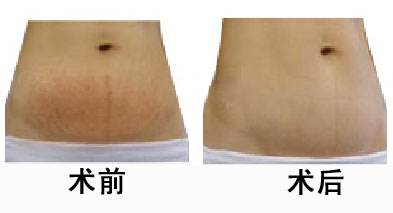 2023石家莊去眼周皺紋醫(yī)院推薦！熱拉提專家團隊排行前十精選！
