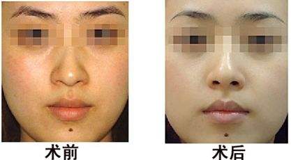 九江男性健康私密專科醫(yī)院推薦！2023年九江男性整形美容口碑排行top10的醫(yī)療機(jī)構(gòu)大揭秘！