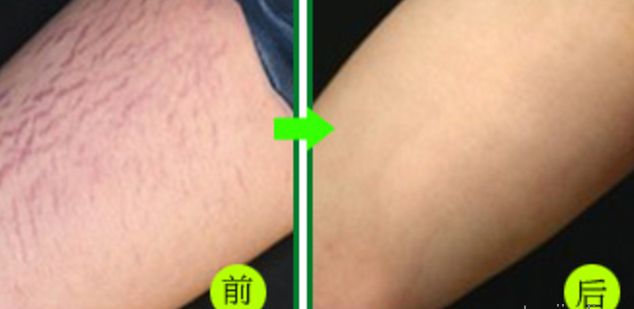 全方位評估，揭秘成都醫(yī)療機構康復整形醫(yī)院的鼻部整形技術！最佳選擇軍大和友誼醫(yī)院等七家備受好評的頂級醫(yī)