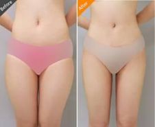 廣州整形美容醫(yī)院推薦排行榜：整容術(shù)后口碑好的TOP10！