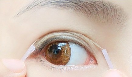 貝加美宋路吸脂效果一般嗎？整形瘦身靠譜嗎？