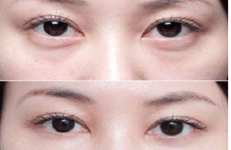 重慶市最受網(wǎng)友歡迎的三家整容醫(yī)院排行榜