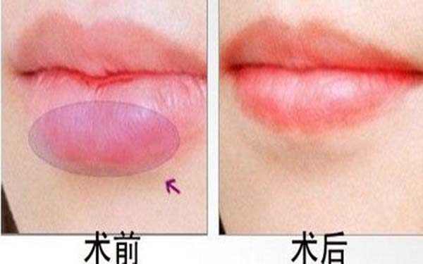 2023年上海膠原蛋白注射美容醫(yī)院排名榜公布，了解優(yōu)質(zhì)整形醫(yī)院！