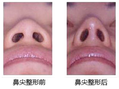 哪些醫(yī)院在合肥頸部皺紋線雕提升領域中具有權威地位？2023年合肥頸部皺紋線雕提升榜單中排名前十的醫(yī)院值得