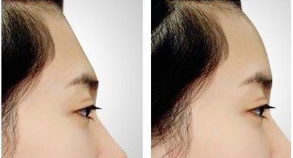 珠海市值得青睞的整形醫(yī)院大揭秘，不容錯(cuò)過哦！