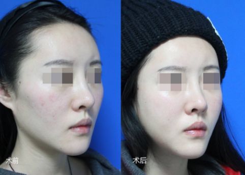 上海整形醫(yī)院大曝光！TOP5排行榜震撼發(fā)布