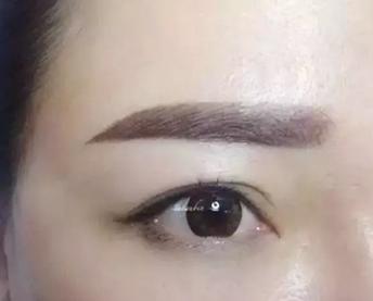寶雞哪家醫(yī)院的吸脂效果好？如何選擇專業(yè)醫(yī)美整形機構？