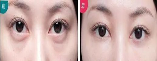 汕頭中心醫(yī)院整容美容效果如何？提供哪些服務(wù)？
