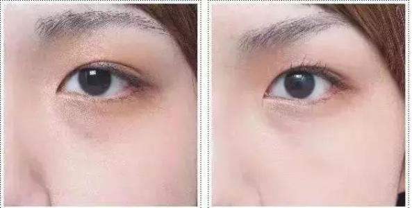 深圳納米光波祛疤醫(yī)院十強排行榜揭曉！這些醫(yī)院備受好評！