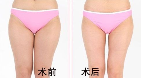 專家薦讀：河南省整形外科醫(yī)院綜合實力大揭秘，受推崇的前四強(qiáng)公布啦！以口碑評價為指南