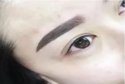 揭秘！深圳市最受歡迎的祛斑美容醫(yī)院TOP8名單公布，美萊領跑
