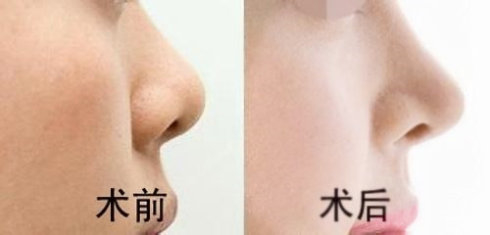 西寧耳軟骨鼻美容醫(yī)院，2023年值得去的前十名醫(yī)療機(jī)構(gòu)揭秘！