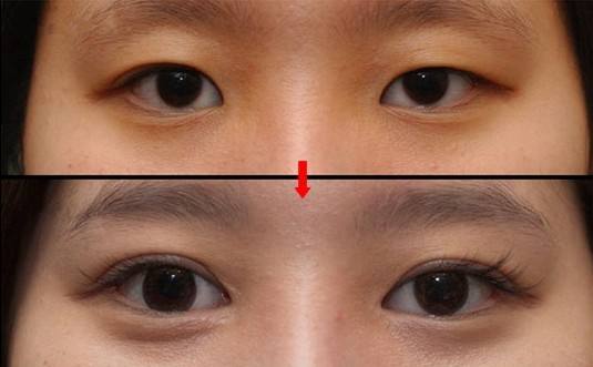 專業(yè)整形醫(yī)院北海華美醫(yī)療的資質(zhì)與醫(yī)生口碑可輕松獲取嗎？如何評價北海華美醫(yī)療美容整形醫(yī)院的資質(zhì)與醫(yī)生口