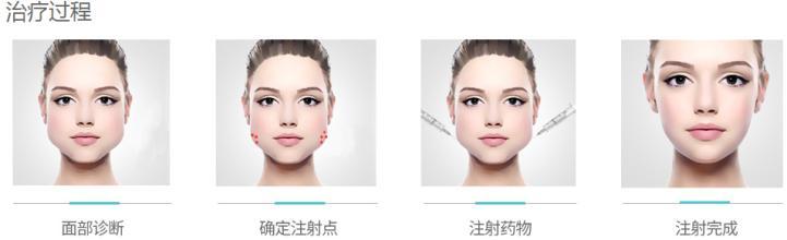 2023泰安膨體填充面部內(nèi)測優(yōu)秀醫(yī)療機構(gòu)公布，口碑好的哪家居榜首？