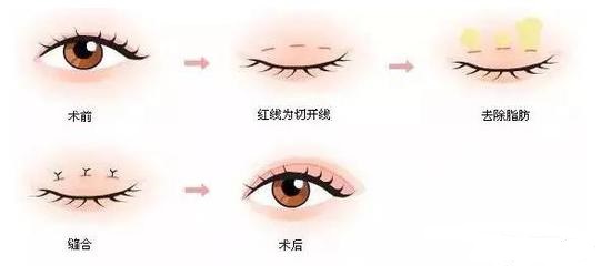 稱霸海口的頸紋神器，哪家醫(yī)院更給力？
