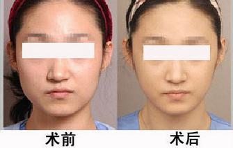 2023年，哪些北京醫(yī)院能給你提供正規(guī)的自體脂肪注射眼底紋醫(yī)療美容服務(wù)？推薦最受口碑贊譽(yù)的美容醫(yī)院列表！