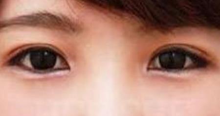 廣州口周紋整形美容醫(yī)院，哪家口碑排行靠前？2023很受歡迎的廣州活細胞口周紋去除專業(yè)醫(yī)院！