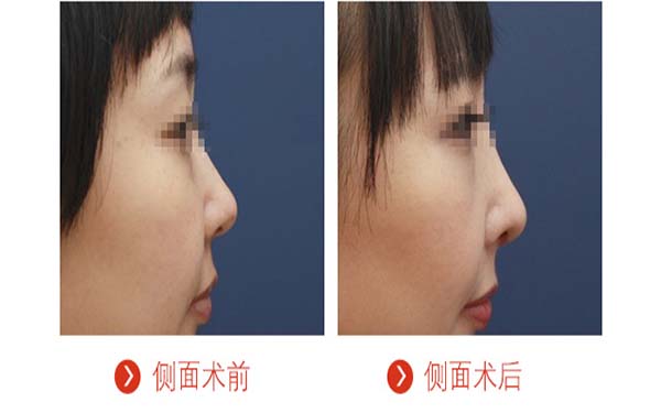 蕪湖華山醫(yī)院醫(yī)療整形科效果好嗎？患者術(shù)后反饋如何？