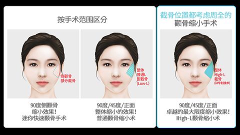 福州大學(xué)附屬醫(yī)院位列福建福州整形醫(yī)院榜首！公私立醫(yī)院詳細(xì)對比！