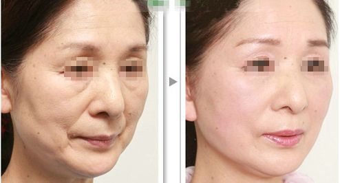 南京獨(dú)步全球！最佳面容革新醫(yī)院現(xiàn)已揭曉！