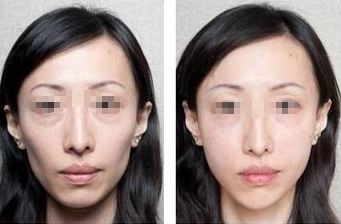 上海磨骨整形估計好的4家醫(yī)院