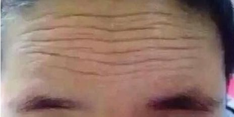 上海哪里有專業(yè)的唇腭裂修復(fù)醫(yī)院？價格怎么樣？排行推薦！