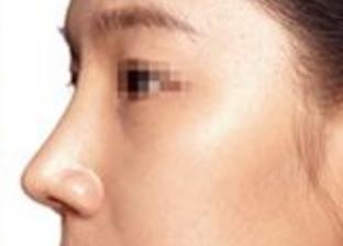 荊州第一人民醫(yī)院醫(yī)療整形美容科口碑好嗎？資質(zhì)如何獲?。?>
										</a>
										<div   id=