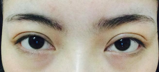 2023江蘇開眼角雙眼皮整形美容醫(yī)院排行榜揭曉！江蘇哪家醫(yī)院做開眼角雙眼皮效果好？這份十強名單給你答案！
