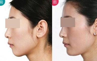 福州地區(qū)皇冠在握！重磅推薦的十大專業(yè)整形醫(yī)院排行榜