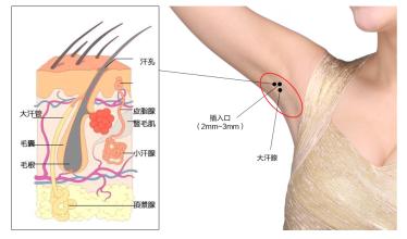 2023年開(kāi)封哪家整形醫(yī)院做臉部祛斑效果好？大揭秘！