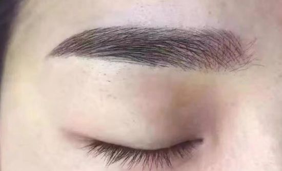 珠海口碑排名前列的脈沖強光去黃褐斑醫(yī)院推薦