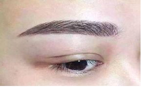 熱門搜索太原哪家醫(yī)院割雙眼皮效果好？top5醫(yī)院推薦