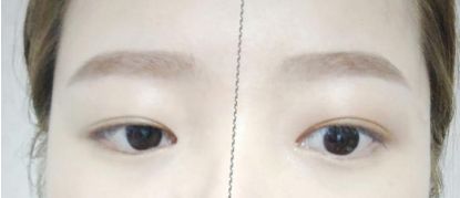 貴陽哪家整形醫(yī)院做兔唇手術(shù)好？排名前十詳解