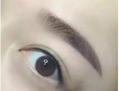 寧波下眼袋提升口碑醫(yī)院推薦榜單