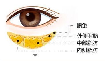 南京超聲溶脂10大名院榜單新鮮出爐，助你告別頑固脂肪！