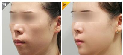 烏魯木齊藥物脫毛：哪家醫(yī)療美容醫(yī)院技術(shù)更權(quán)威？