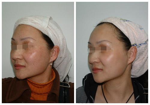 浙江杭州口碑佳的拉皮除皺整形美容醫(yī)院TOP榜單推薦