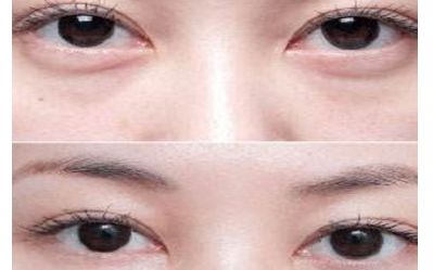昆明鼻部整形醫(yī)院推薦：網(wǎng)友力薦的專業(yè)醫(yī)療機(jī)構(gòu)