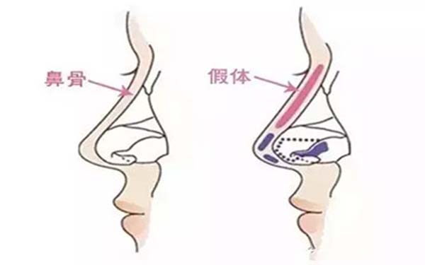【北京吸脂】哪家好？【手術(shù)醫(yī)院】評(píng)價(jià)推薦！暢銷七家