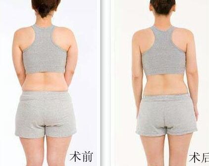太原市祛斑醫(yī)院排名榜單最新發(fā)布，附帶醫(yī)院簡介