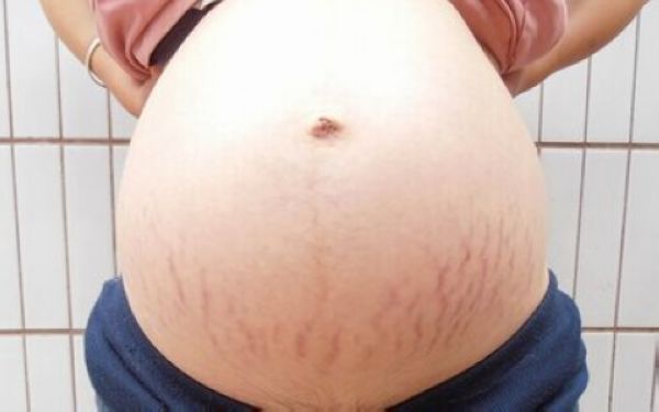 濟南眼部去皺紋手術權威醫(yī)院排行榜Top10【最新】
