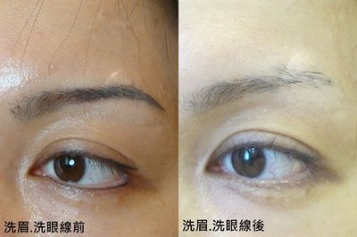 成都唇紋整形醫(yī)院排行榜前十最新揭曉！