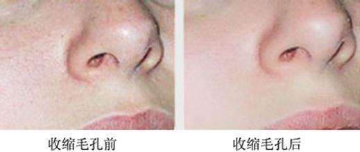 長(zhǎng)沙水光針美容醫(yī)院2023排名TOP10，哪家性價(jià)比高？去除眼角紋效果佳！