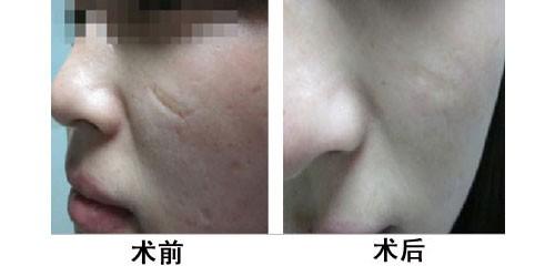 2023年周口哪家醫(yī)院最適合進(jìn)行超聲炮去眼周細(xì)紋的整形美容手術(shù)？評(píng)分前十的專業(yè)機(jī)構(gòu)推薦點(diǎn)評(píng)！