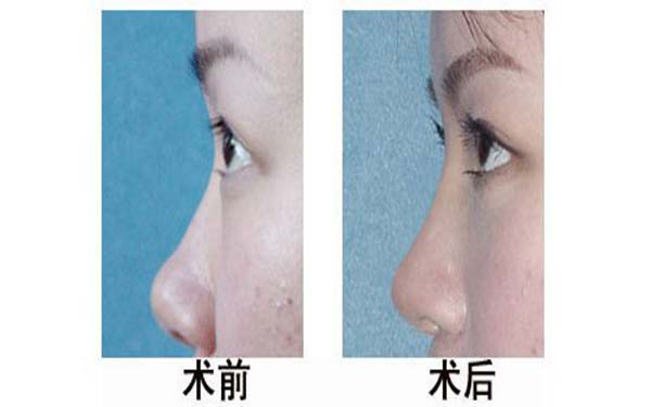 廣州美貝爾醫(yī)療美容整形醫(yī)院位于哪里？醫(yī)生有何簡(jiǎn)歷？?jī)r(jià)格如何？
