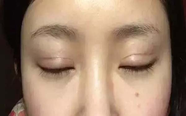 2023年臺(tái)州乳房下垂治療前十強(qiáng)整形醫(yī)院曝光，這家醫(yī)院是選擇！